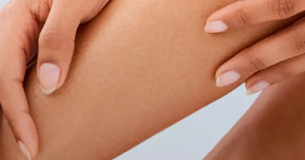 Contenthairremoval Min